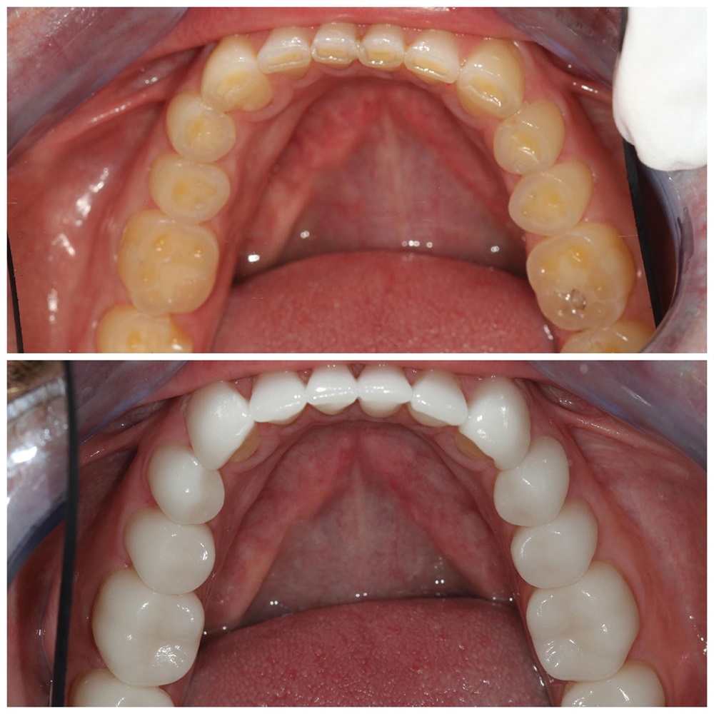 Grant Olson Case Study